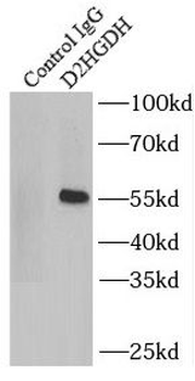 D2HGDH Rabbit Polyclonal Antibody