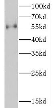 D2HGDH Rabbit Polyclonal Antibody