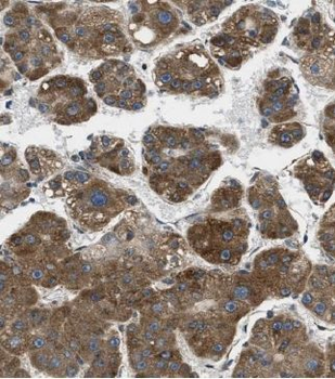 D2HGDH Rabbit Polyclonal Antibody
