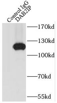 DAB2IP Rabbit Polyclonal Antibody