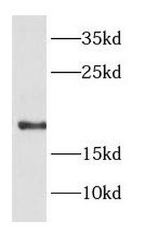 DAD1 Rabbit Polyclonal Antibody