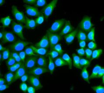 DAO Rabbit Polyclonal Antibody