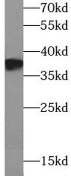 DAO Rabbit Polyclonal Antibody