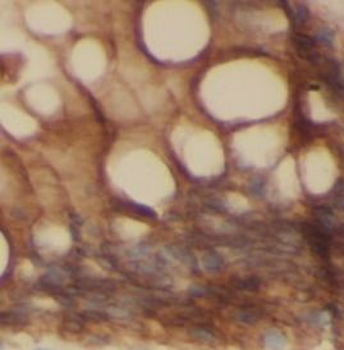 DAO Rabbit Polyclonal Antibody