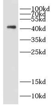 DAP3 Rabbit Polyclonal Antibody