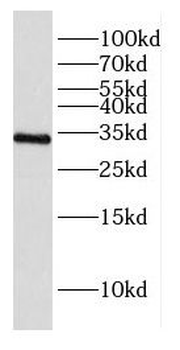 ACKR1 Rabbit Polyclonal Antibody