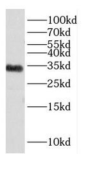 PPP1R1B Rabbit Polyclonal Antibody