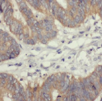PPP1R1B Rabbit Polyclonal Antibody