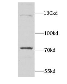 DARS2 Rabbit Polyclonal Antibody