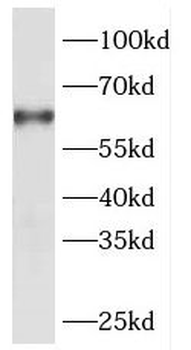 DBR1 Rabbit Polyclonal Antibody