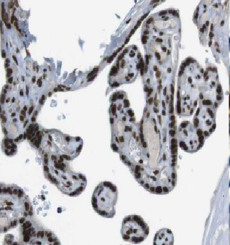 DBR1 Rabbit Polyclonal Antibody