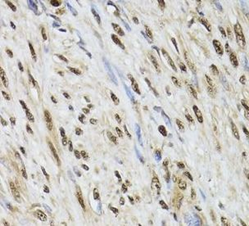 DCK Rabbit Polyclonal Antibody