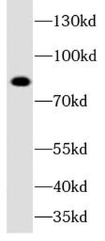 DCLK1 Rabbit Polyclonal Antibody