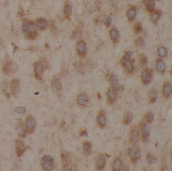 DCLK1 Rabbit Polyclonal Antibody
