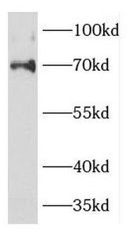 DCP1A Antibody