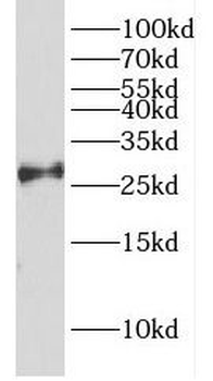 DCUN1D1 Rabbit Polyclonal Antibody