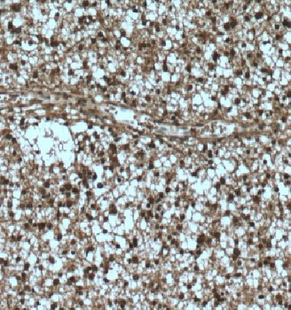 DCUN1D1 Rabbit Polyclonal Antibody