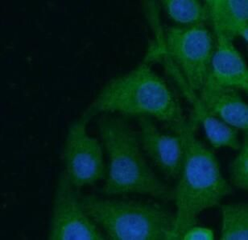 DCX Rabbit Polyclonal Antibody