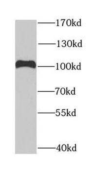DDX1 Antibody