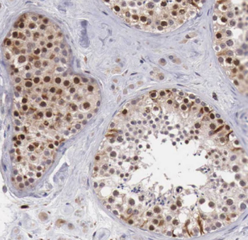 DDX39A Rabbit Polyclonal Antibody