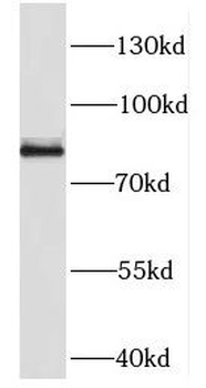 DDX50 Rabbit Polyclonal Antibody