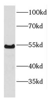 DDX6 Rabbit Polyclonal Antibody