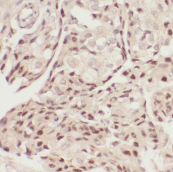 DDX6 Rabbit Polyclonal Antibody