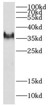 DEDD2 Rabbit Polyclonal Antibody