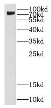 DEF6 Rabbit Polyclonal Antibody