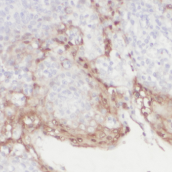 DEF6 Rabbit Polyclonal Antibody