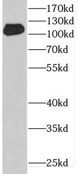 DENND1A Antibody
