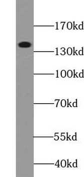 DENND3 Antibody