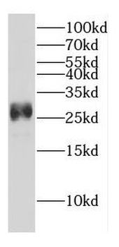 DENR Rabbit Polyclonal Antibody