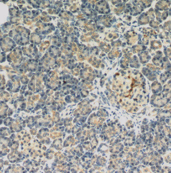 DPT Rabbit Polyclonal Antibody