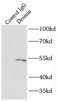 DES Rabbit Polyclonal Antibody