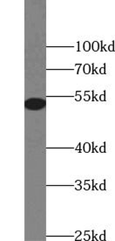DES Rabbit Polyclonal Antibody