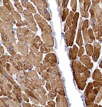 DES Rabbit Polyclonal Antibody