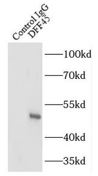 DFFA Rabbit Polyclonal Antibody