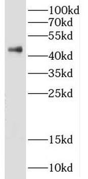 DFFA Rabbit Polyclonal Antibody