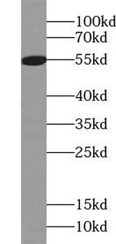 GSDME Rabbit Polyclonal Antibody