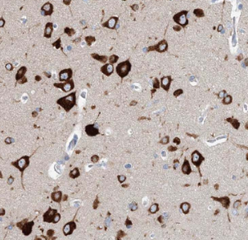 GSDME Rabbit Polyclonal Antibody