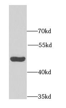 DHODH Rabbit Polyclonal Antibody
