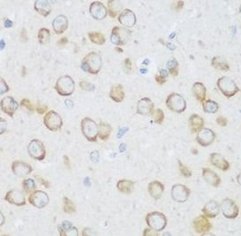 DHODH Rabbit Polyclonal Antibody