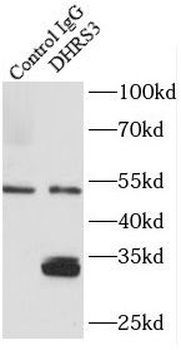 DHRS3 Rabbit Polyclonal Antibody
