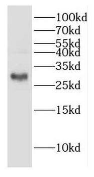 DHRS3 Rabbit Polyclonal Antibody