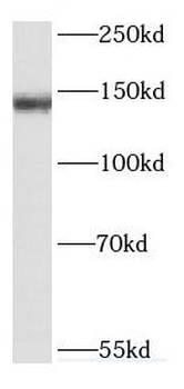 DHX38 Rabbit Polyclonal Antibody