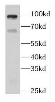 DIS3L2 Rabbit Polyclonal Antibody