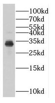 DKK1 Rabbit Polyclonal Antibody