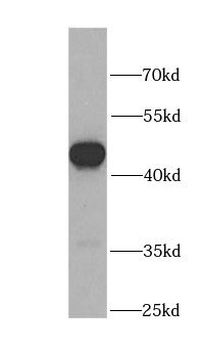 DLK1 Rabbit Polyclonal Antibody