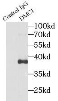 DMC1 Antibody